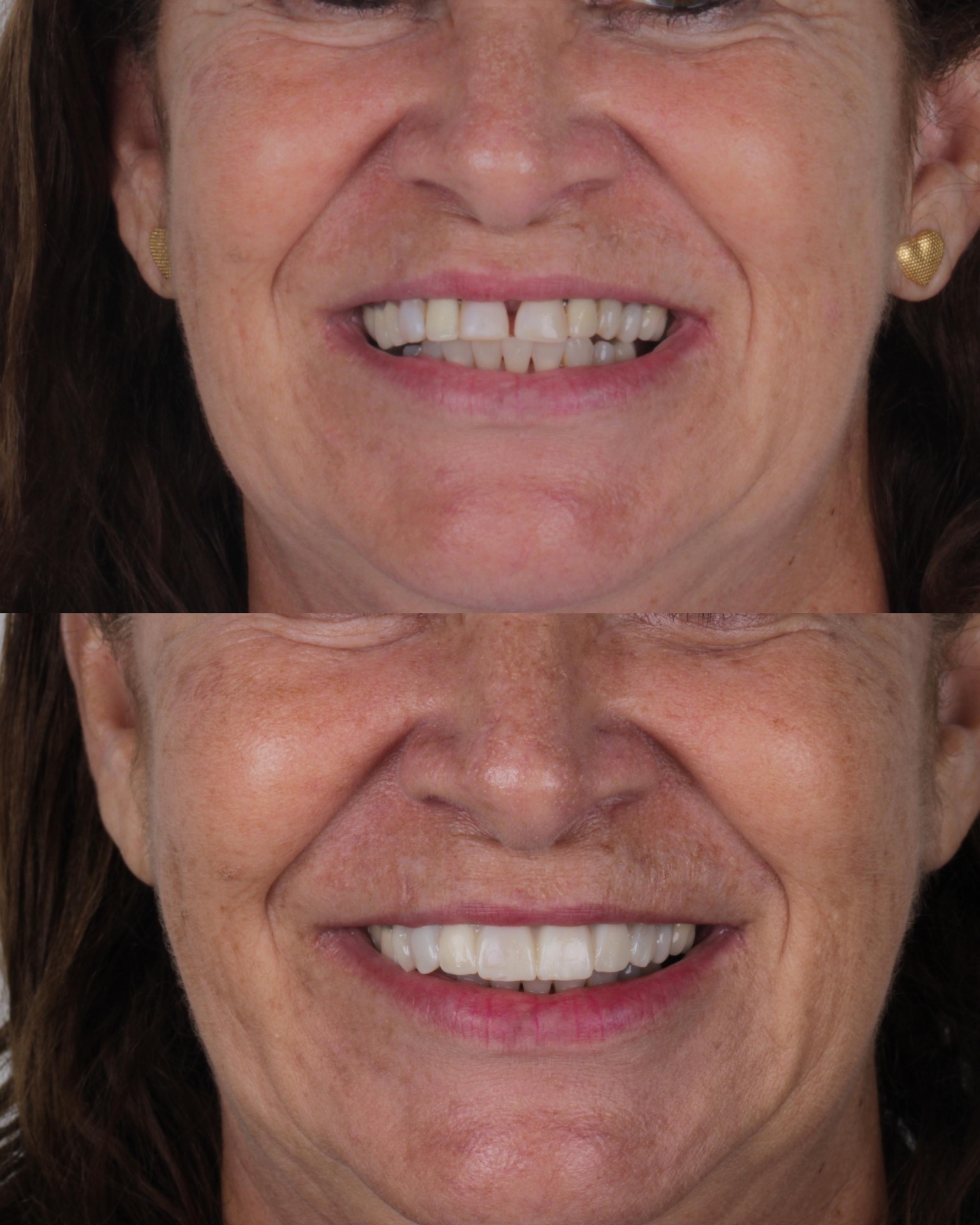 Antes e depois 3